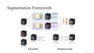 Stroke lesion segmentation [upl. by Htebazie]