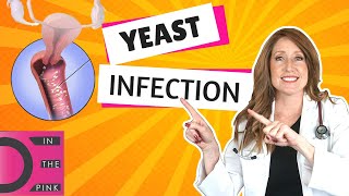 Yeast Infections 8 interesting facts you didnt know [upl. by Lessig]