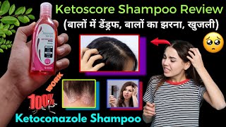 Ketoscore shampoo uses in hindi  Ketoconazole shampoo  Ketoscore shampoo review  Ketoscore [upl. by Pirozzo]