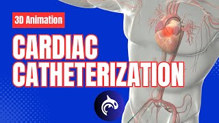 Cardiac Catheterization  3D Animation [upl. by Eisaj]