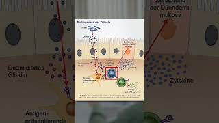 Pathogenese der Zöliakie [upl. by Cath542]