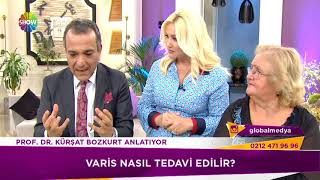 Varis Nasıl Tedavi Edilir  ProfDrAhmet Kürşat Bozkurt [upl. by Nosidam]