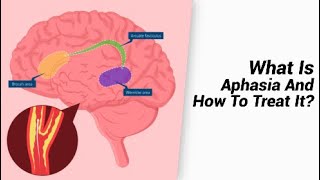 What Is Aphasia And How To Treat It [upl. by Hilda]