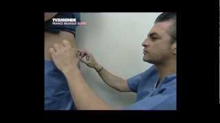 Lipolyse de labdomen par le Docteur Thierry LAFITTE TV5 Mondemp4 [upl. by Demetra]