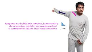 013 Subclavius muscle stretching exercise [upl. by Swee207]