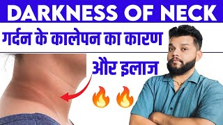 गर्दन और घुटने के कालापन से छुटकारा 🔥 Darkness Of Neck Treatment  Acanthosis Nigricans In Hindi [upl. by Rozele]