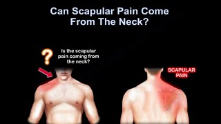 Neck pain or shoulder pain WHY IT HURTS [upl. by Durant729]