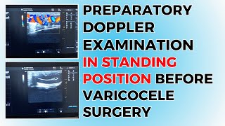 Preparatory Examination Before Varicocele Surgery [upl. by Agna63]