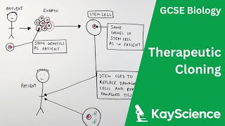 Therapeutic Cloning  GCSE Biology  kaysciencecom [upl. by Blodget]