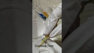 Oxidase test [upl. by Assenaj594]