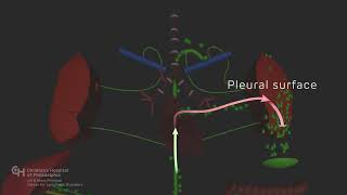 Chylothorax [upl. by Esir]