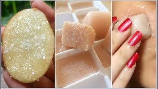 Potato Facial to remove dark spots pimples amp acne scars suntan crystal clear skinSkin whitening [upl. by Adialeda]