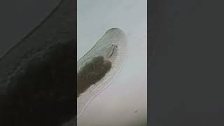 Flatworm Platyhelminthes under the microscope microscopy microscope science biology [upl. by Moonier]