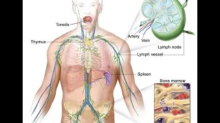 Hodgkin Lymphoma [upl. by Vinni]