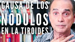 Episodio 1111 Causa De Los Nódulos En La Tiroides [upl. by Randie]