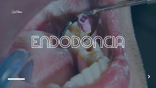 ENDODONCIA  DENTAL CALIFORNIA [upl. by Ainesell937]