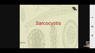 Sarcocystis para L3 [upl. by Nadirehs]