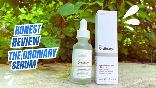 Honest review on the ordinary niacinamide 10 and zinc 1 serum  ordinary serum review [upl. by Crin476]