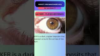 Kayser Fleischer Ring Image Based Important Question🙋 Norcet 8 ytshorts [upl. by Colley]