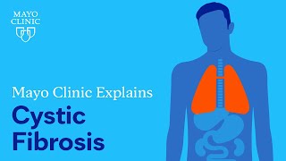 Mayo Clinic Explains Cystic Fibrosis [upl. by Osnerol]