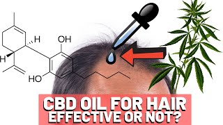 CBD Oil Hair Growth  Should You Try It [upl. by Idahs808]