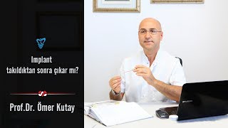 İmplant Takıldıktan Sonra Çıkar Mı  Prof Dr Ömer Kutay [upl. by Poock]