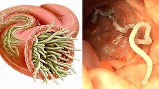 7 Herbs That Can Kill Internal Parasites Naturally [upl. by Graehme44]