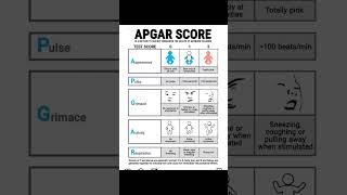 APGAR Score [upl. by Nairrot929]