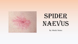 Spider naevus  causes pathophysiology sign value [upl. by Nevear]