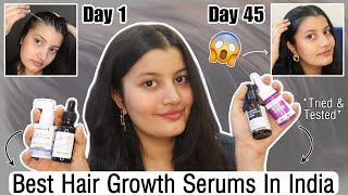 Hair Growth Serums That Actually Work  Best In India [upl. by Robina]