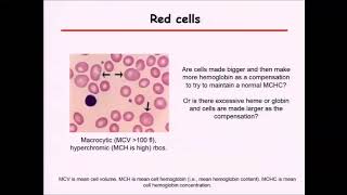 Myelodysplastic syndrome MDS and anemia [upl. by Rico]