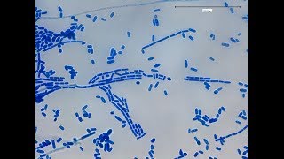 Geotricum growth on SDA and its fungal structures on LPCB preparation [upl. by Brad]