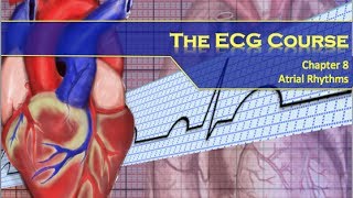 The ECG Course  Atrial Rhythms [upl. by Rettuc870]