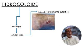 HIDROCOLOIDE Parte 2 [upl. by Seko]