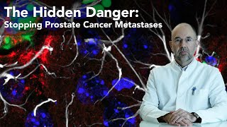 Prostate Cancers Hidden Danger How to Stop Metastases [upl. by Zarger]