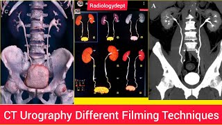 CT Urography Trace Ureters Filmy technique In Hindi  Cturography Radiologydept Ctscan ctkub [upl. by Rustice101]