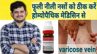 Powerful Homeopathic Medicine for Varicose veins [upl. by Odell]