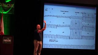 Understanding Ventricular Tachycardia [upl. by Kym513]