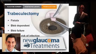 Trabeculectomy Glaucoma Surgery [upl. by Selegna]