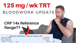 TRT blood work update 125mgweek [upl. by Nevag]