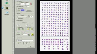 AxioVision  Module  TMA [upl. by Madid]