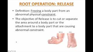 Lesson 3  Root Operation Release [upl. by Hcaz]