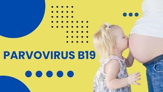 Parvovirus B19 Infection  Fifth Disease  Clinical Features Diagnosis and Management [upl. by Brighton]