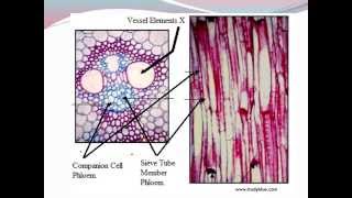 IGCSE 27 Translocation [upl. by Asetal]