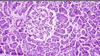 Biochemical Basis of Diabetes Mellitus [upl. by Aicemak]