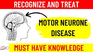 What is Motor Neuron Disease MND  All you need to know  Causes  Symptoms  Diagnosis Treatment [upl. by Saied]