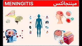 meningitis  mannjites  मेनिंजाइटिस [upl. by Licht]