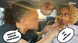 Hickey Prank on Boyfriend  He Broke Up With Me [upl. by Poul389]