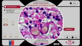 Imágenes Histopatológicas Modelo experimental de inflamación por implante de Agar [upl. by Anyale]