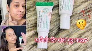 AxisY dark spot correcting glow serum  একনি দাগ মুক্ত সিরাম  serum review [upl. by Toback968]